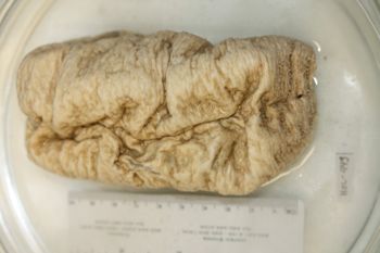 Media type: image;   Invertebrate Zoology HOL-449 Description: Preserved specimen.;